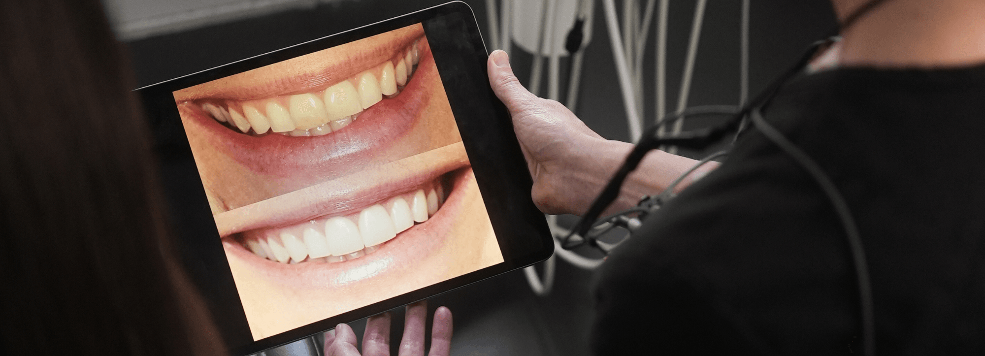 Cosmetic Dentistry