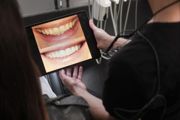Cosmetic Dental Treatments From Quick Fixes to Full Makeovers - Whitespace Dental