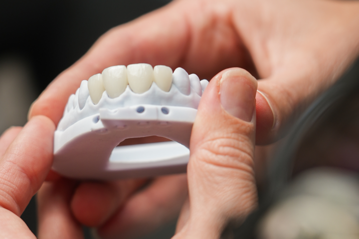 Digital mock-up of porcelain veneers being held by a dental professional, illustrating the comprehensive cosmetic transformation achievable when comparing Teeth Whitening vs. Veneers for a better smile.