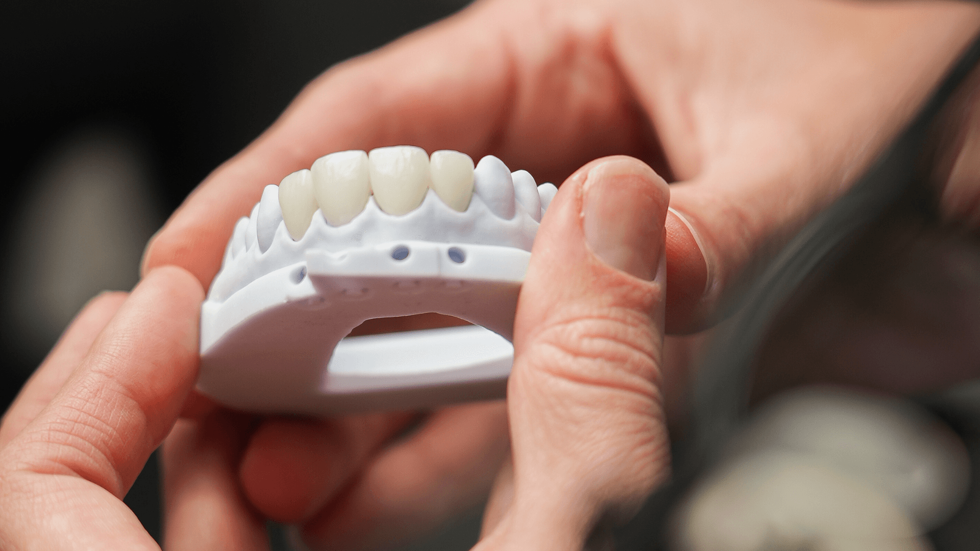 Digital mock-up of porcelain veneers being held by a dental professional, illustrating the comprehensive cosmetic transformation achievable when comparing Teeth Whitening vs. Veneers for a better smile.